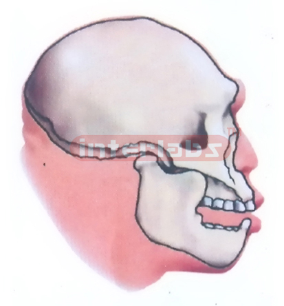 MAUER JAW OR HEIDELBERG MAN